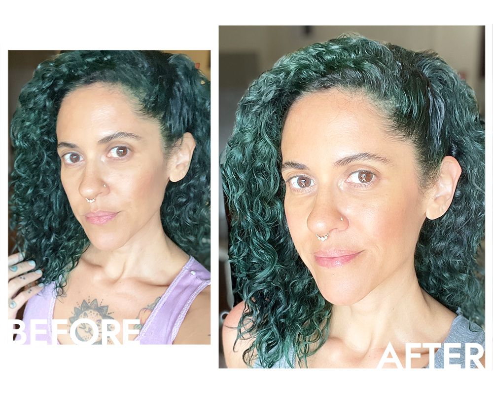 Autor antes e depois de aplicar soro para o soro do couro cabeludo do couro cabeludo