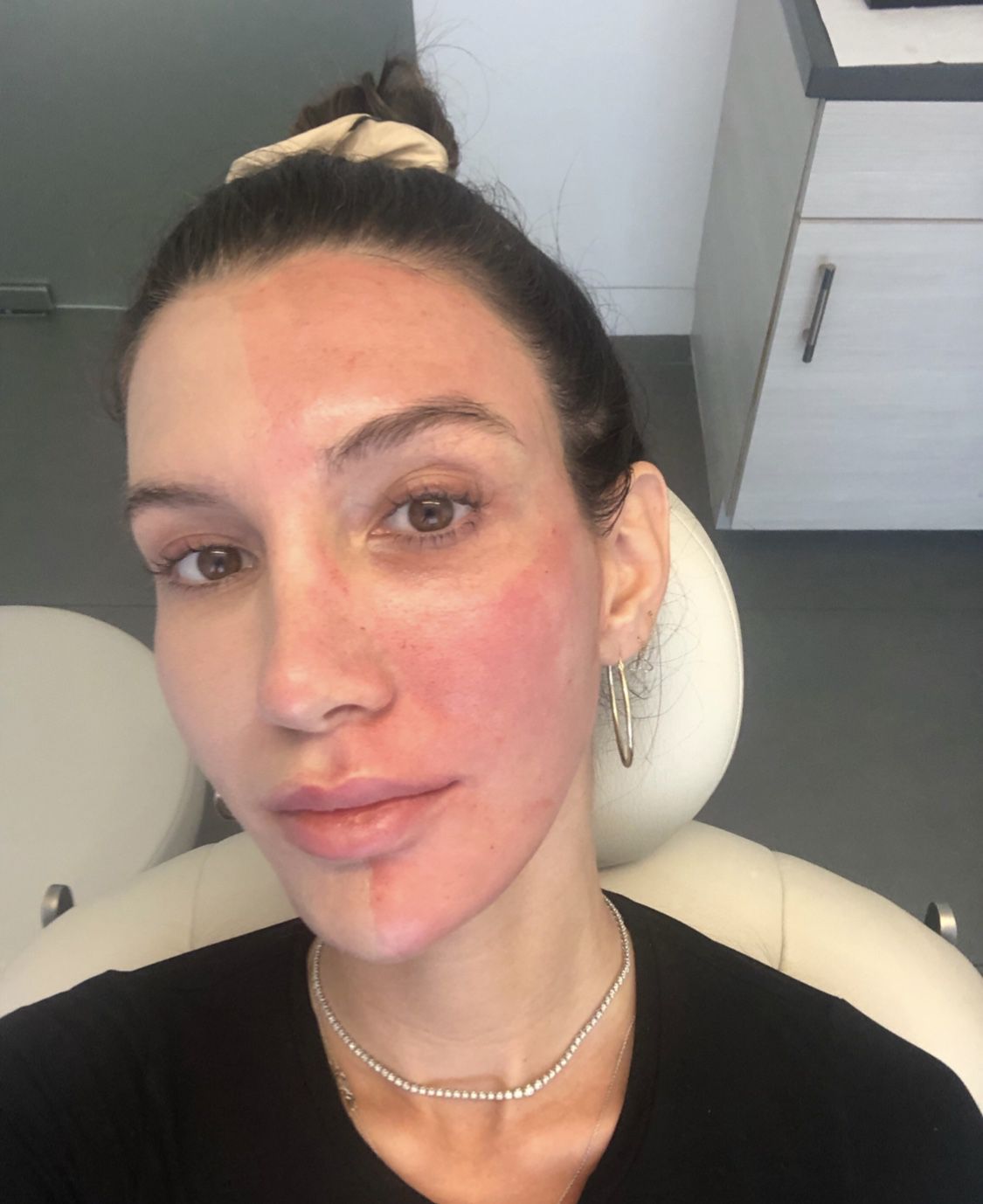 Metade do rosto de uma mulher com base oxigenante Oxygenetix durante teste com Tanya Akim