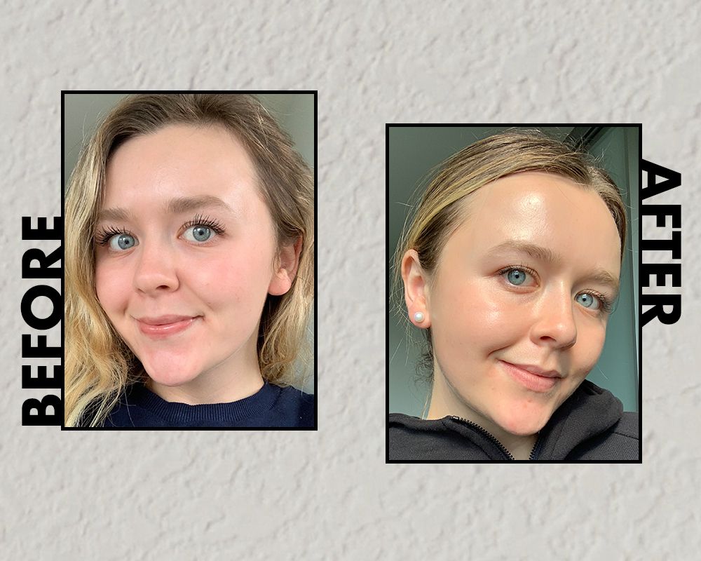 Soro feminino com niacinamida antes e depois da foto