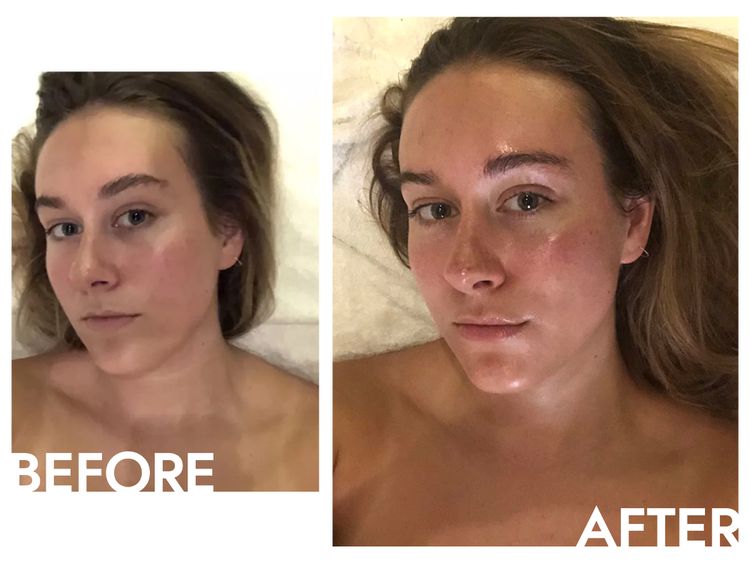 O autor antes e depois do procedimento de cuidados com o rosto de Shani Darden